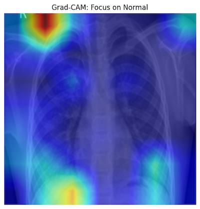 Grad-CAM for Normal X-ray